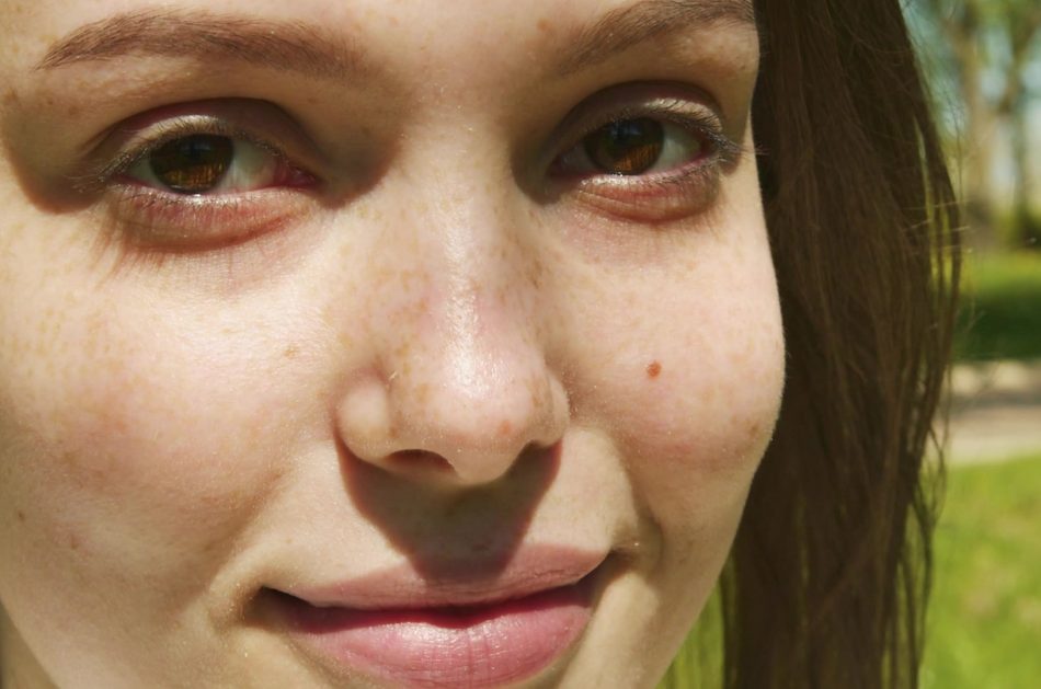 Natürlich gesunde Haut – das Startmotiv von SKIN